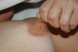 Nipples