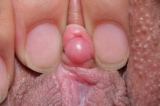 xxx