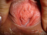 xxx