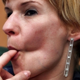Sucker face mature