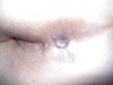 Fickrosettenarschlo