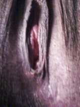 Pics