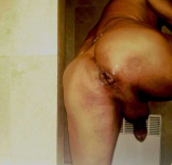 My asse hole