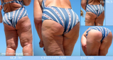 BBW and SSBBW beach voyeur (My work)