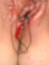 april and a needle