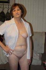 Hairy woman - gallery 1