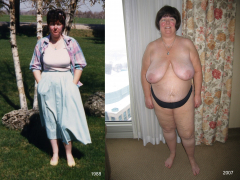 Patricia McKinney - Then and Now - N