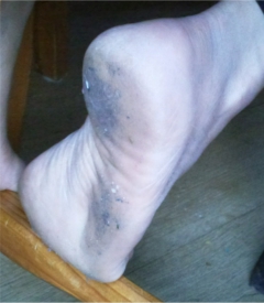 indian feet - N