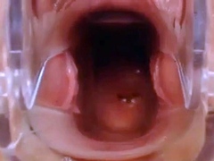 Webcam Pussy Play With Speculum